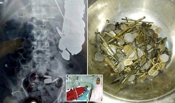 Foto: Twitter/ @ChaoticCrown.