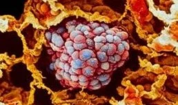 Un antibiótico peligroso destruye incluso el ADN