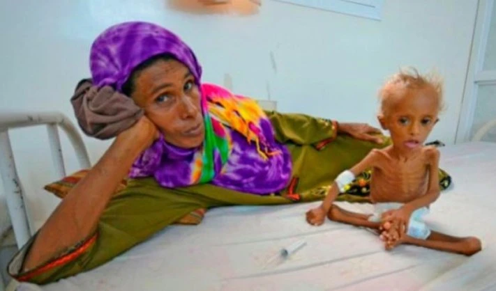 Un millón 800 mil niños y un millón 100 mil mujeres embarazadas sufren de desnutrición aguda.