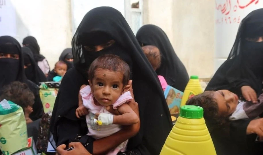 Triste realidad en Yemen.