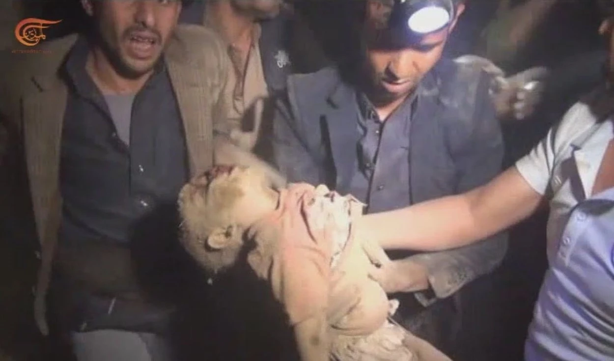 En la imagen uno de los niños asesinados en la masacre saudita contra los civiles yemenitas en la ciudad de Amran.