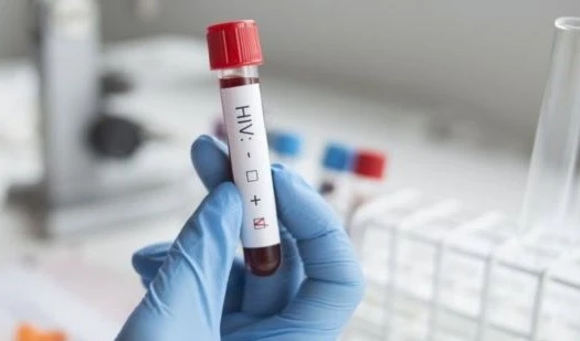 ONU reitera compromiso de poner fin a epidemia del SIDA de aquí a 2030 ONU reitera compromiso de poner fin a epidemia del SIDA de aquí a 2030