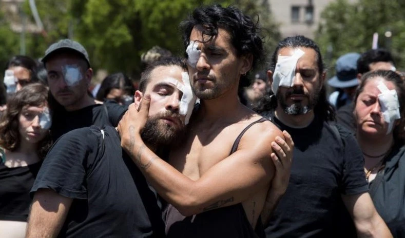 A 241 ascienden en Chile las personas con serias lesiones oculares por represión policial a protestas