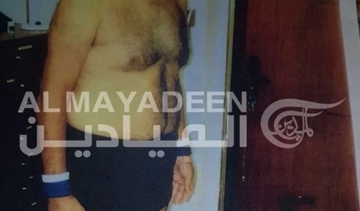 Al Mayadeen obtiene fotos sobre torturas aplicadas al prisionero palestino Walid Hanache.