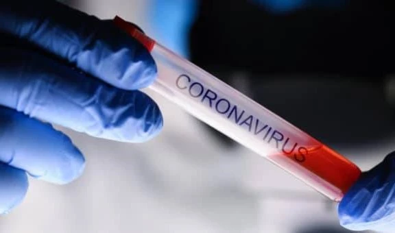 La cifra de contagios por Covid-19 supera los 50 millones en todo el mundo. La cifra de contagios por Covid-19 supera los 50 millones en todo el mundo.