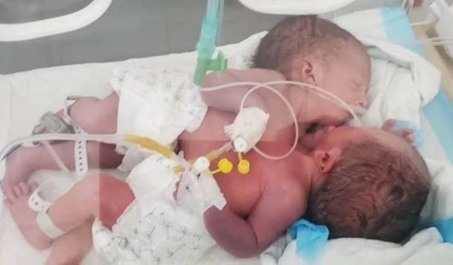 Ministro yemení  de Salud: El bloqueo provoca decenas de muertos y Naciones Unidas apoya este crimen