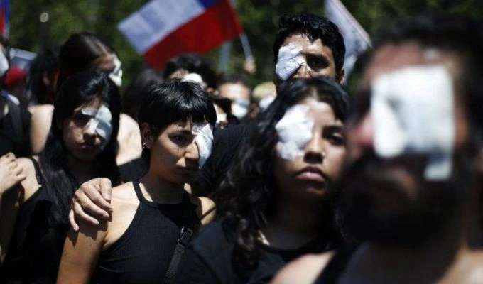 Se suicida joven chileno que sufrió trauma ocular durante manifestaciones de 2019