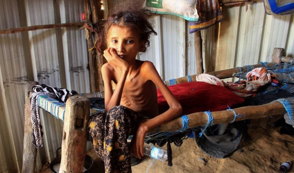 Ministerio de Salud yemení presenta resultados de 6 años de guerra y bloqueo (Foto: AFP)