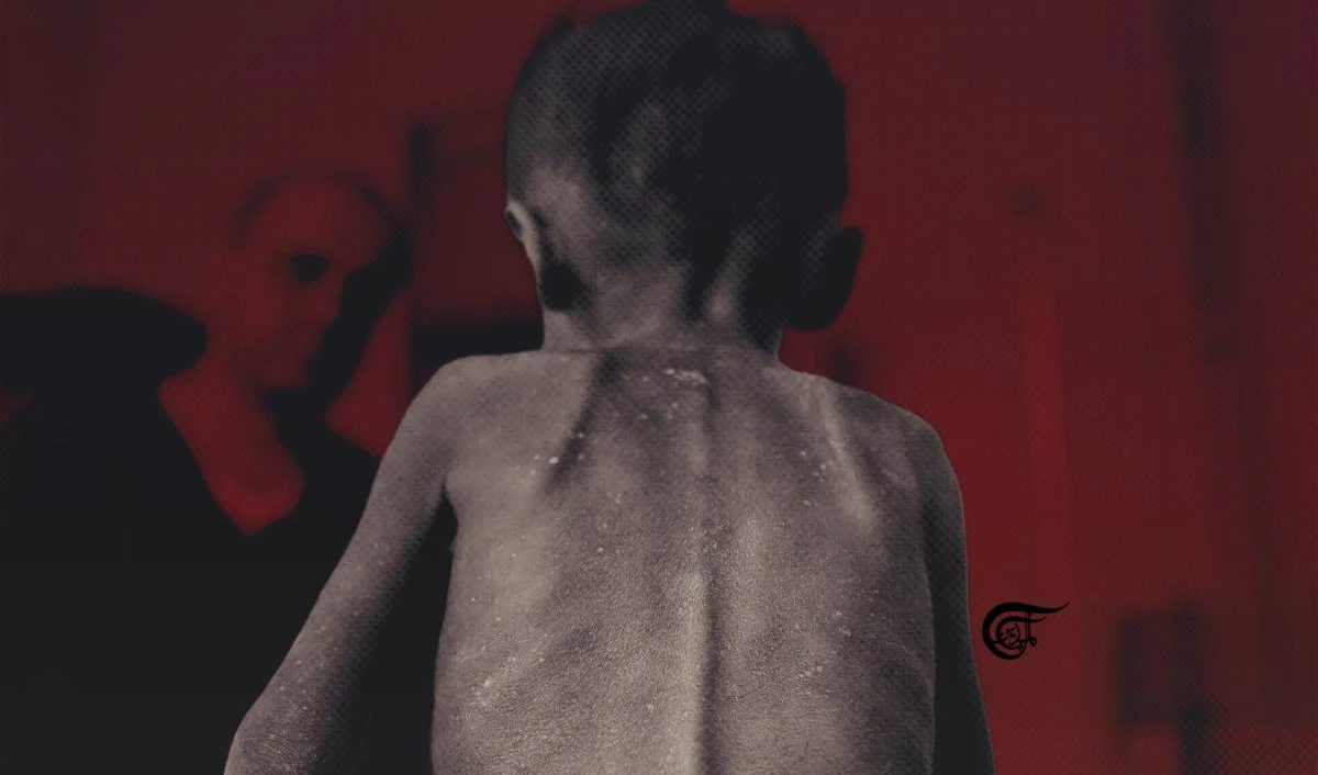 El mundo fracasa en ayudar a Yemen