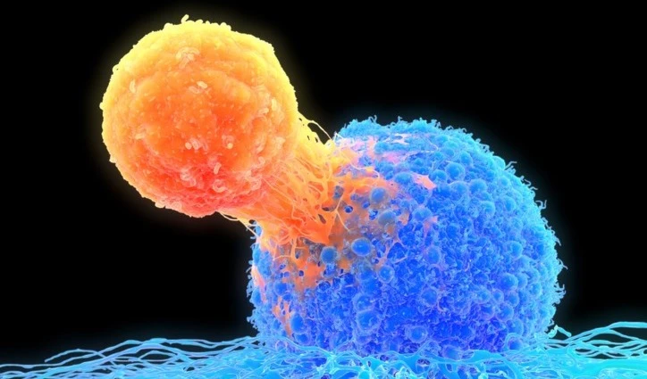 Células cancerígenas. Foto: Getty Images.