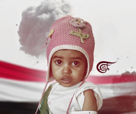 Niños yemenitas enfermos de leucemia mueren debido al bloqueo estadounidense-saudita.