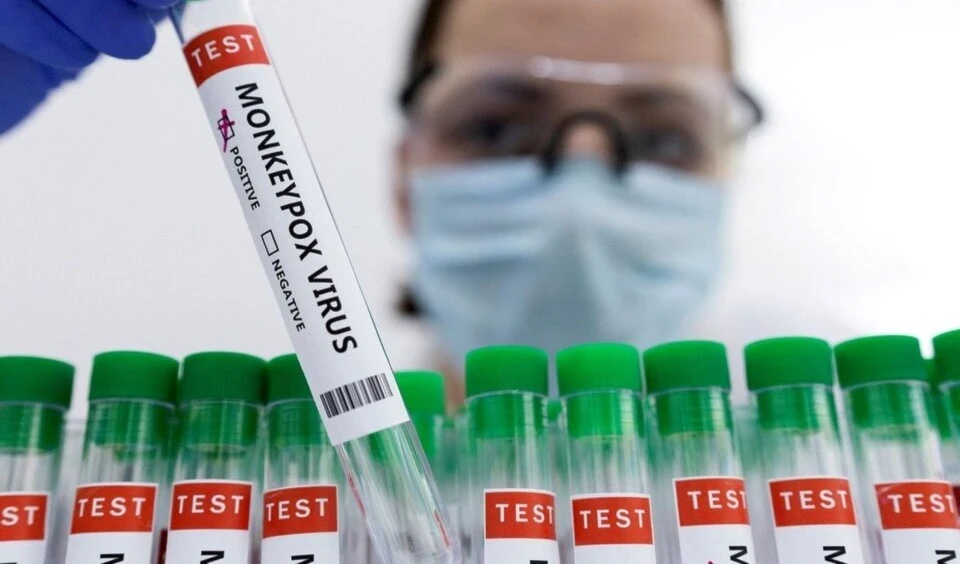 OMS mantiene viruela del mono como emergencia sanitaria. Foto: AFP.