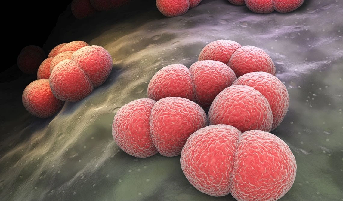 Meningitis. Foto: Hospital HM.