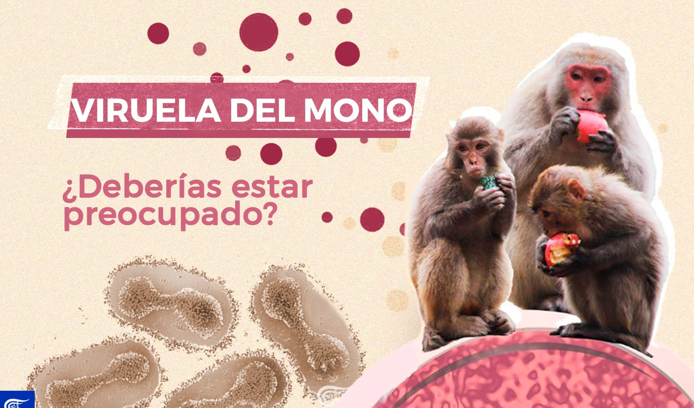 Viruela del mono, ¿deberías estar preocupado?