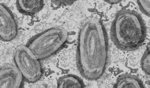 Estados Unidos supera los 3.500 casos de la viruela del mono