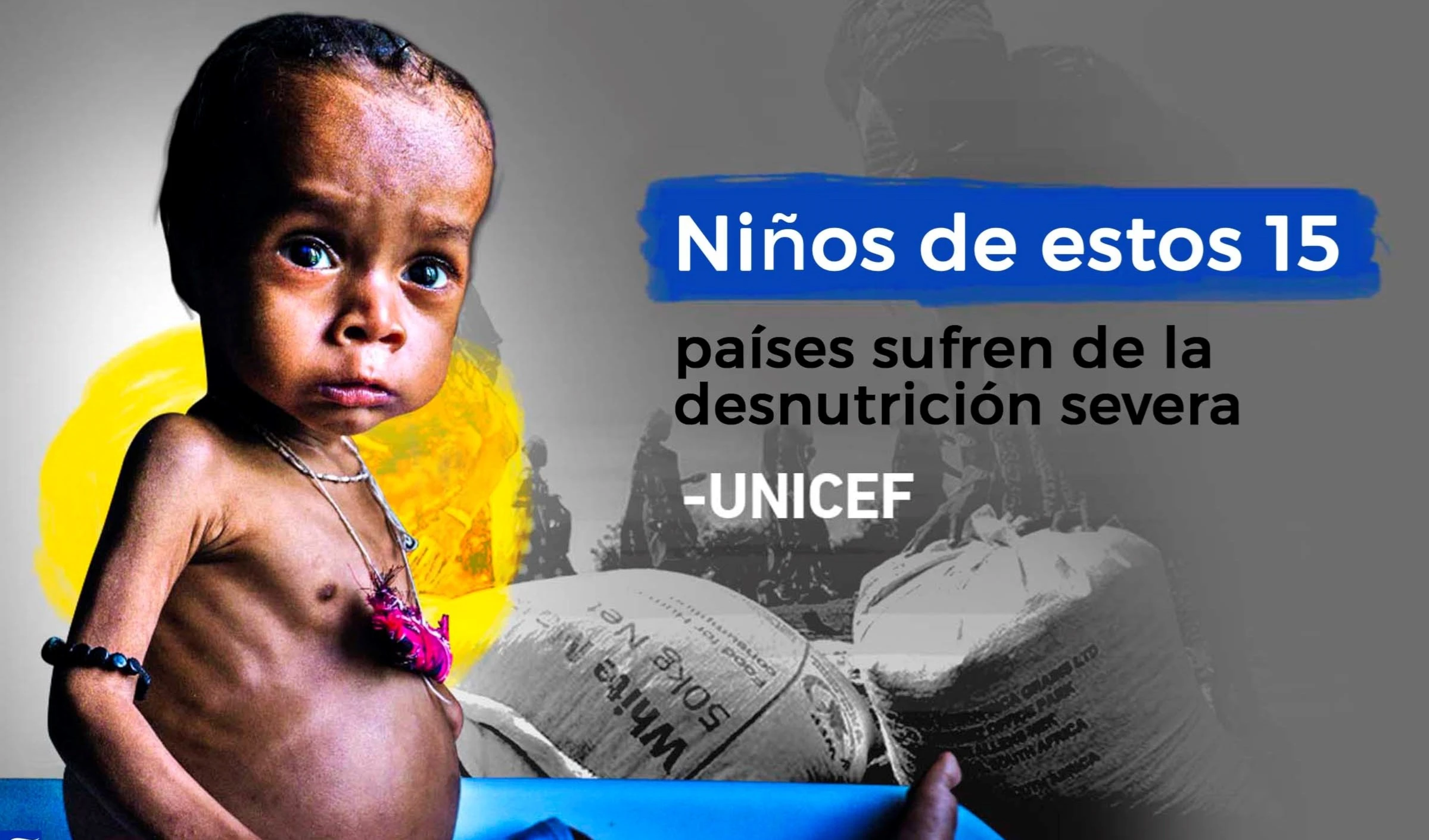 Niños de estos 15 países sufren de la desnutrición severa