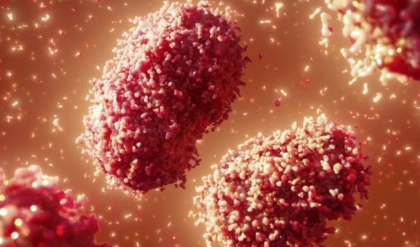 Confirman segundo fallecido por viruela símica en Brasil