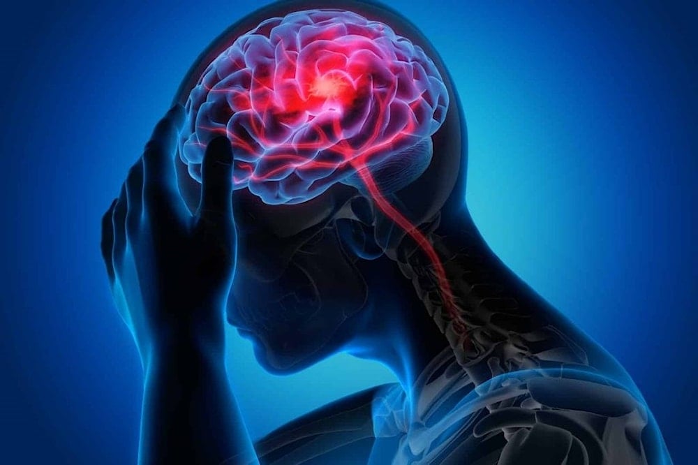 Ejercicios intensos pueden inducir accidentes cerebrovasculares. Foto: Shutterstock. 