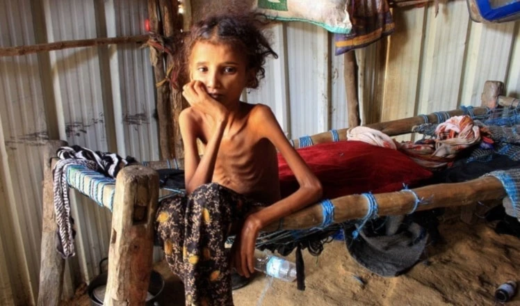 Empeoran las crisis de Yemen