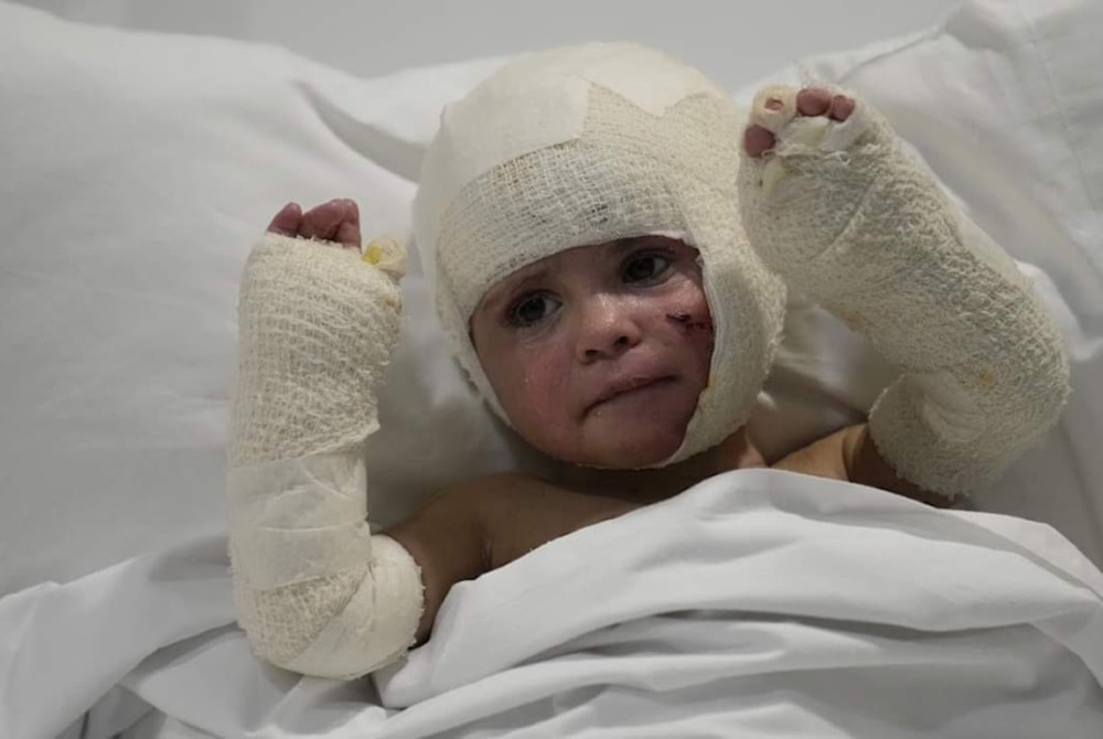 Niño libanés herido durante los ataques israelíes.