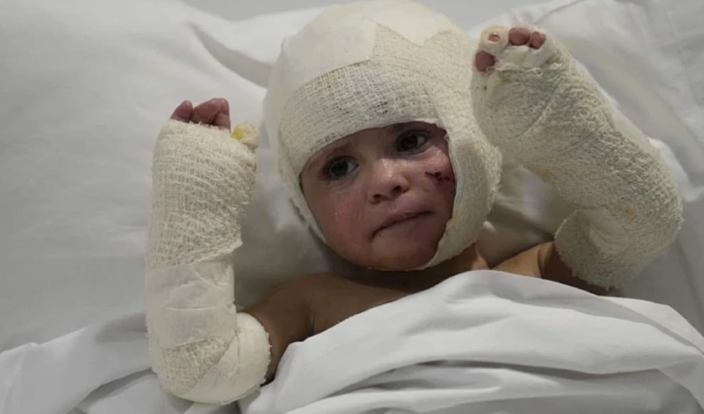Niño libanés herido durante los ataques israelíes.