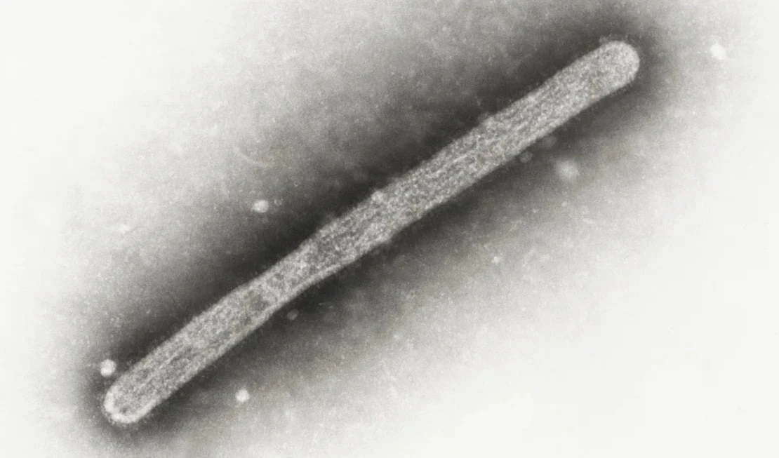 Encuentran casos no reportados de gripe aviar en Estados Unidos. Foto: AP. Encuentran casos no reportados de gripe aviar en Estados Unidos. Foto: AP.