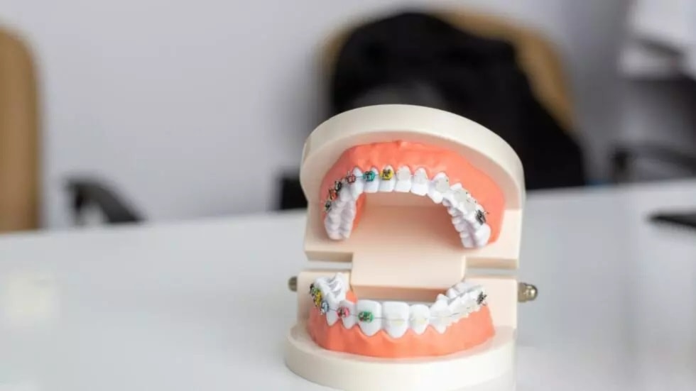 Investigadores de Japón prueban fármaco regenerador de dientes. Foto: Unsplash. 