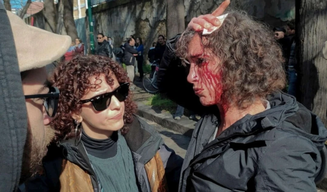 Durante los choques varios de los manifestantes resultaron heridos.