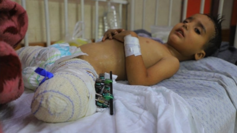 Ahmed Shabat, de tres años. Foto tomada de BBC. 