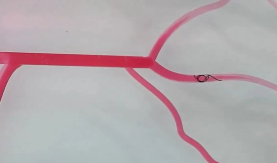 Crean en China un robot para ayudar a tratar tumores cerebrales. Foto: Science Robotics