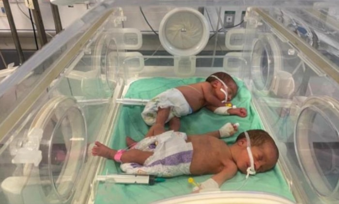 Mueren 15 niños por desnutrición en Gaza.