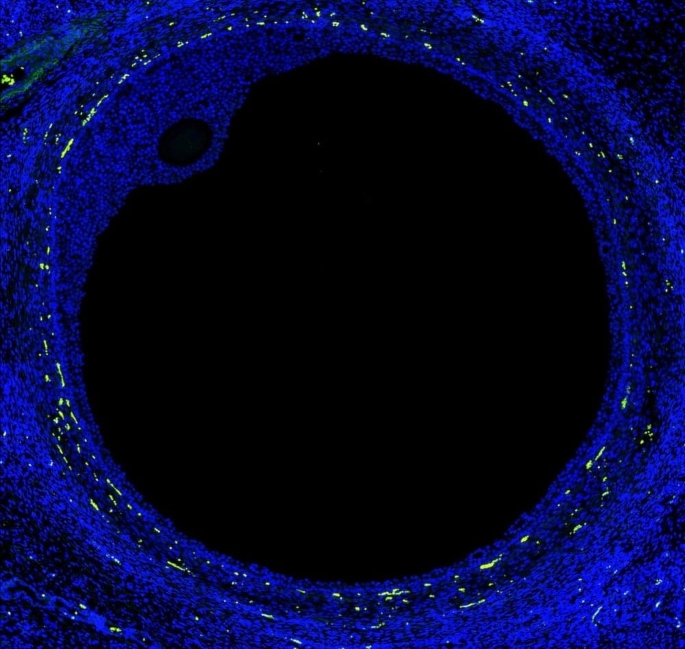 Primer atlas celular del ovario humano abre vías a la fertilidad