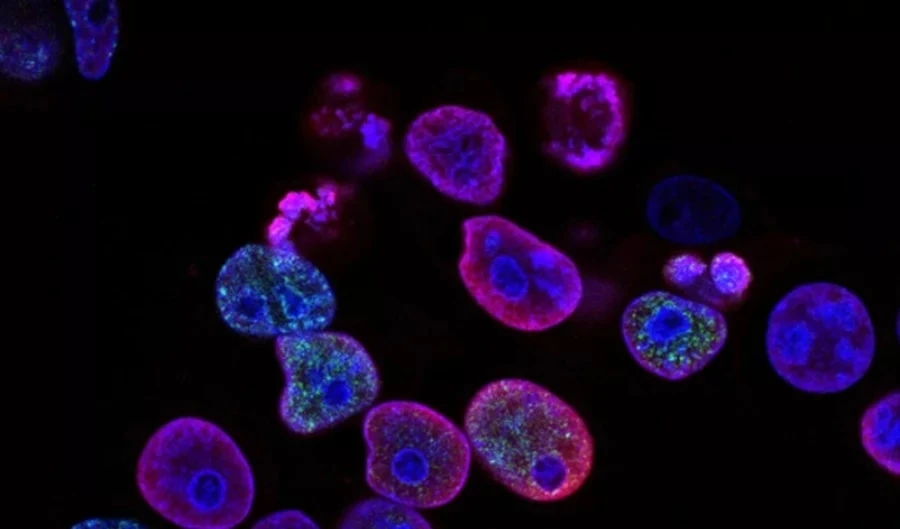 Terapias pioneras con células madre frenan la esclerosis múltiple. Foto: Unsplash.