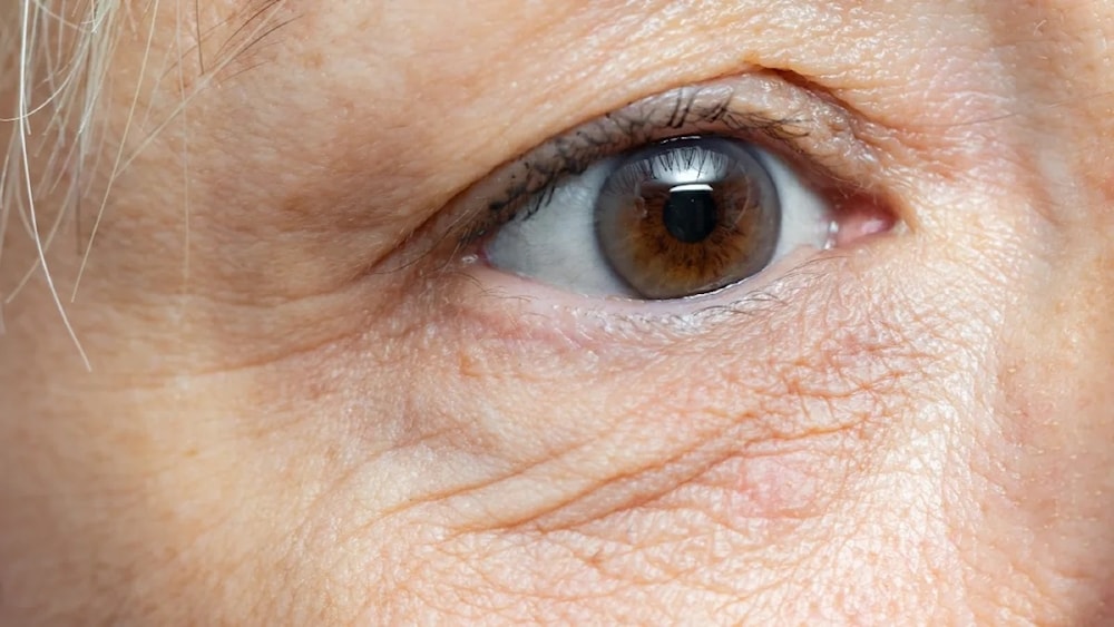 Revelan las claves para combatir las arrugas alrededor de los ojos. Foto: Woman's World. 