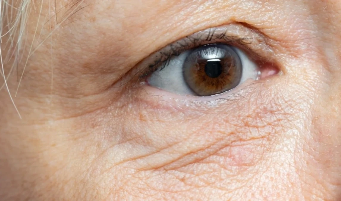 Revelan las claves para combatir las arrugas alrededor de los ojos. Foto: Woman's World.