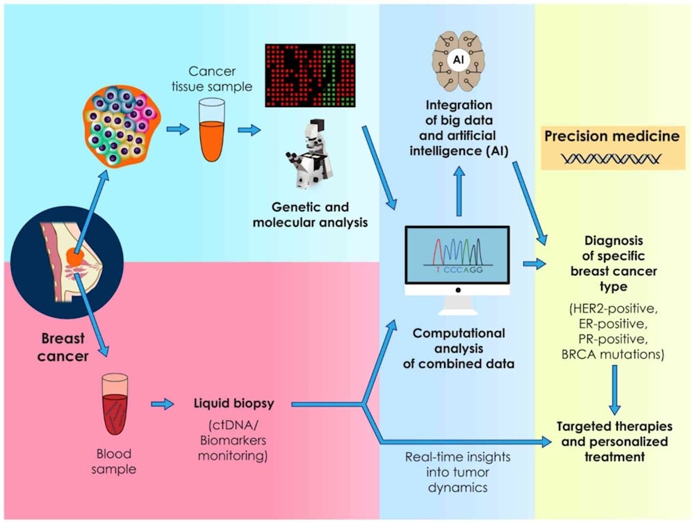Tratamiento para el cáncer de mama: Innovación y esperanza