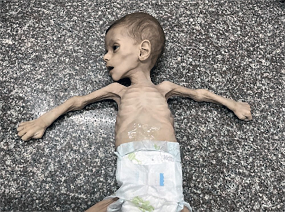 Fayez Ataya, un bebé de seis meses muerto por desnutrición en Gaza. 