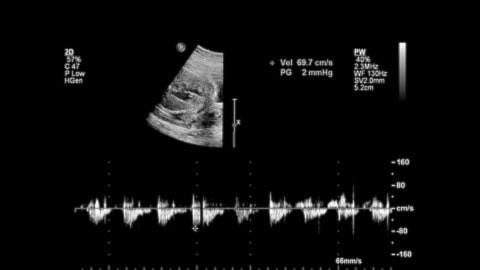 El aprendizaje de idiomas comienza en la etapa fetal