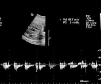 El aprendizaje de idiomas comienza en la etapa fetal