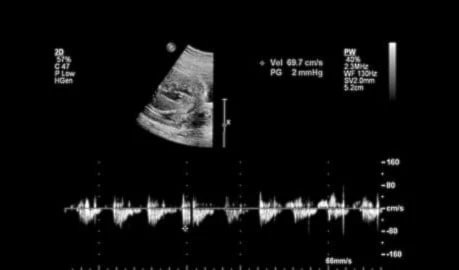 El aprendizaje de idiomas comienza en la etapa fetal