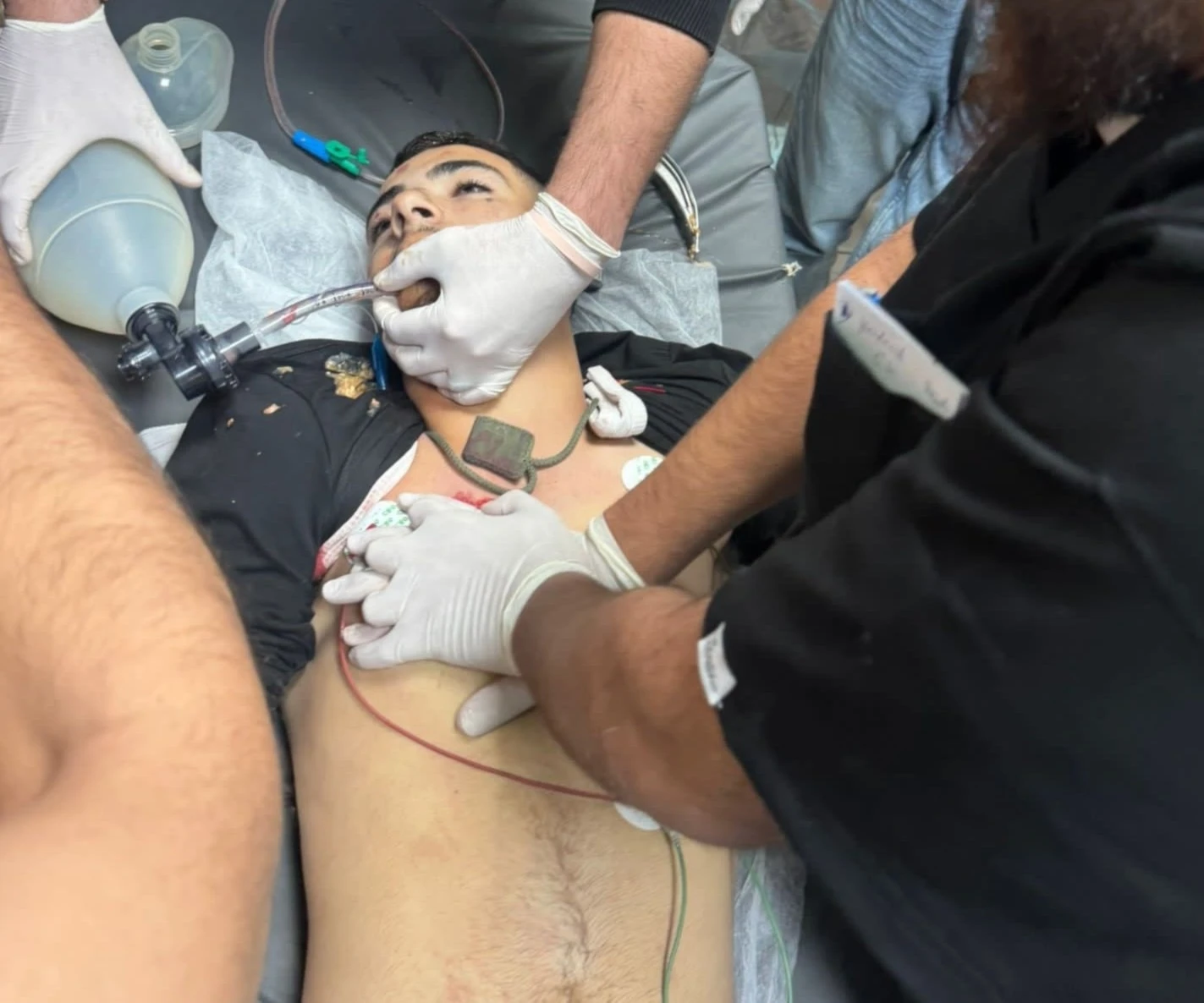 Los dos mártires tenían 16 y 18 años. (Foto: Redes Sociales)