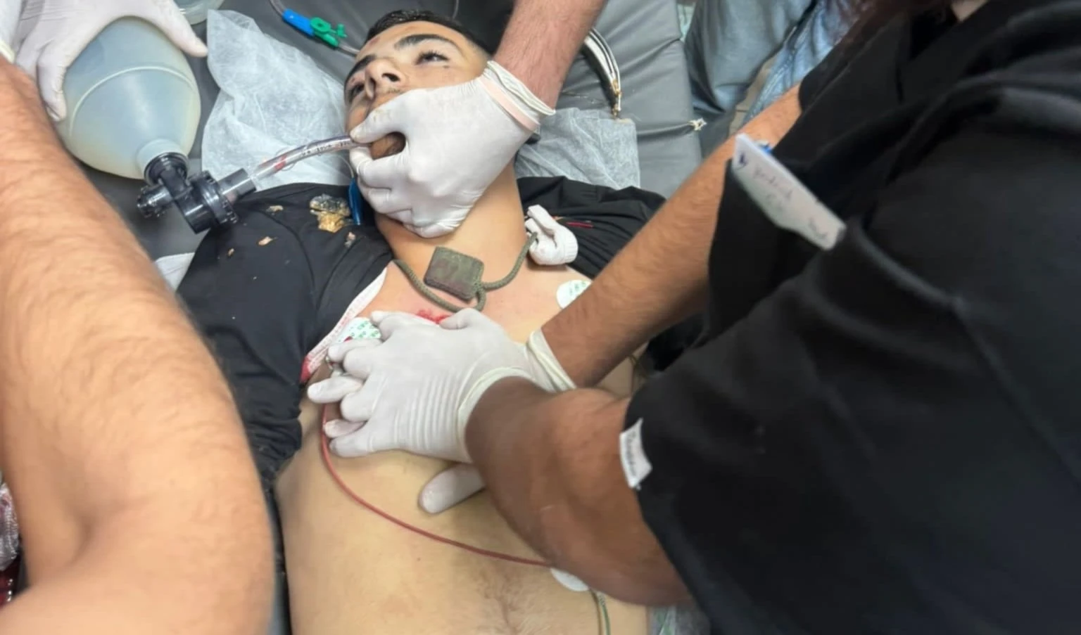 Los dos mártires tenían 16 y 18 años. (Foto: Redes Sociales)