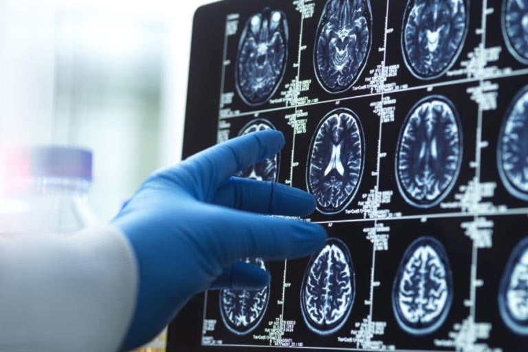 Adolescencia cerebral: por qué termina a los 32 años