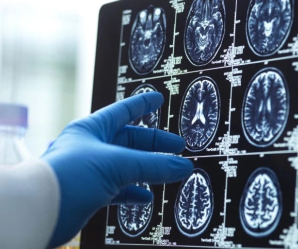 Adolescencia cerebral: por qué termina a los 32 años