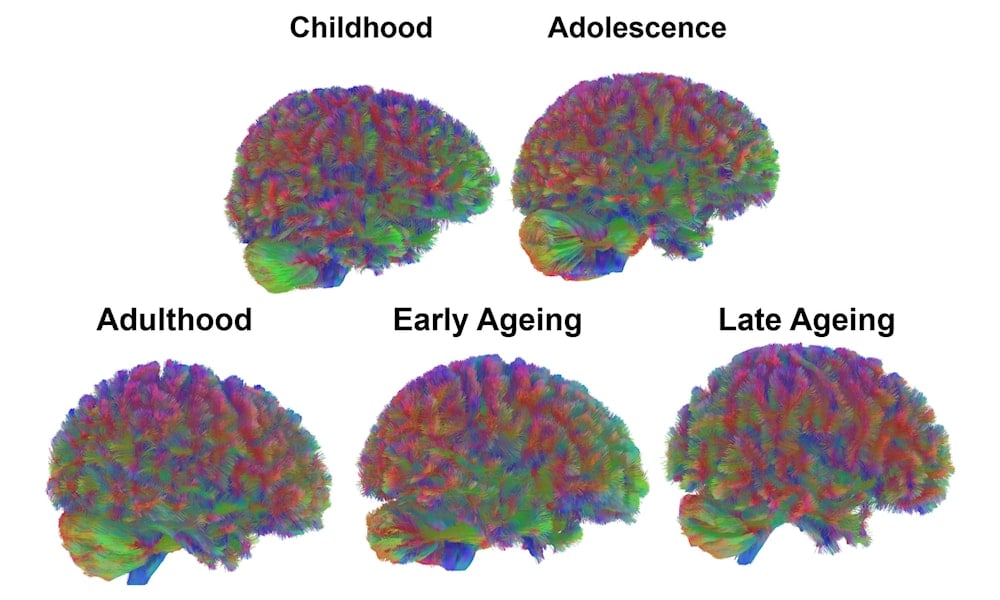 Adolescencia cerebral: por qué termina a los 32 años