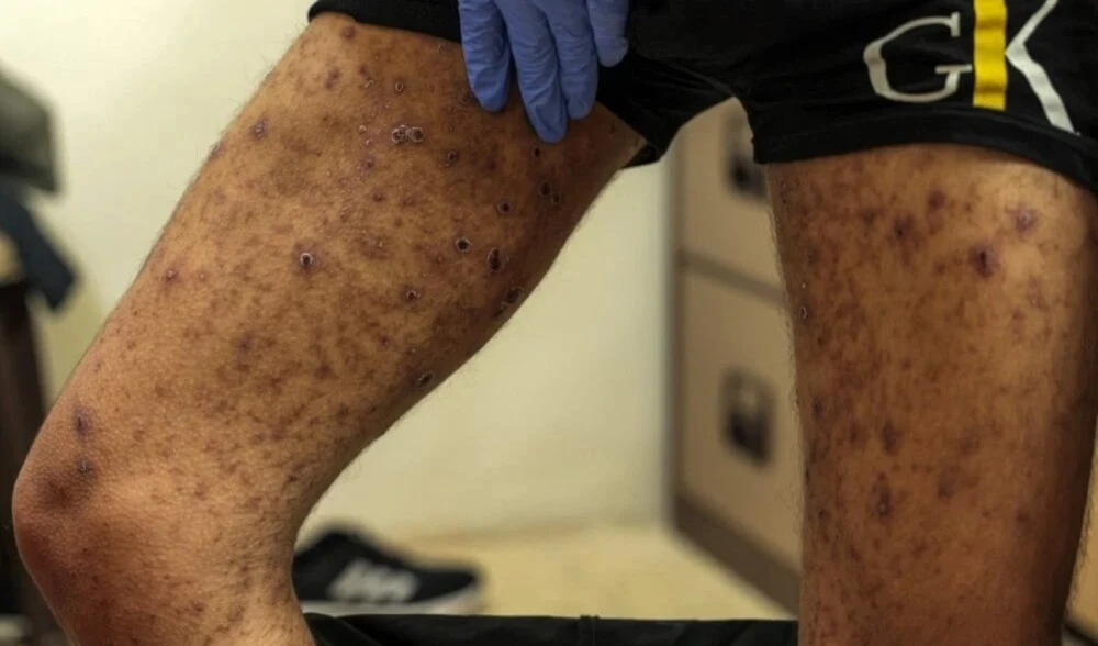 Exprisionero palestino denuncia negligencia médica en cárceles israelíes (Foto: AFP)