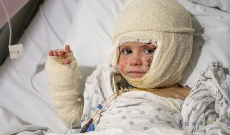 Niño libanés de dos años sufre quemaduras graves tras ataque aéreo israelí. Niño libanés de dos años sufre quemaduras graves tras ataque aéreo israelí.
