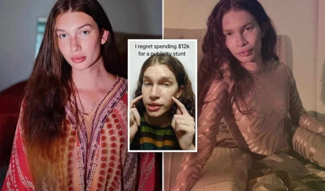 ¿Lucir como gata? Los intentos fallidos de una tiktoker