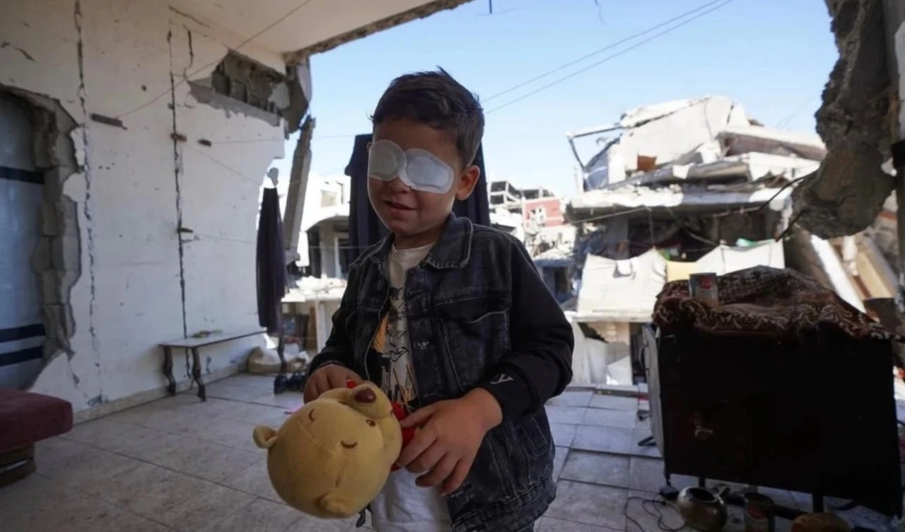 El niño Mahammad Hijazi perdió la vista como consecuencia de la explosión de una bomba israelí. El niño Mahammad Hijazi perdió la vista como consecuencia de la explosión de una bomba israelí.