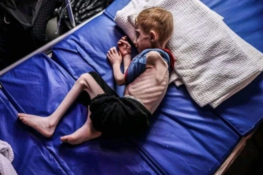 De acuerdo con la OMS, unos 71 mil niños menores de cinco años sufrirán desnutrición aguda en Gaza durante los próximos once meses.